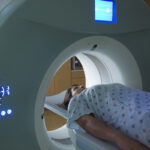 Woman Receiving a medical Scan for Breast Cancer Diagnosis